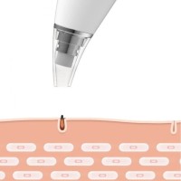 Электрический очиститель пор Xiaomi InFace Blackhead (MS7000)